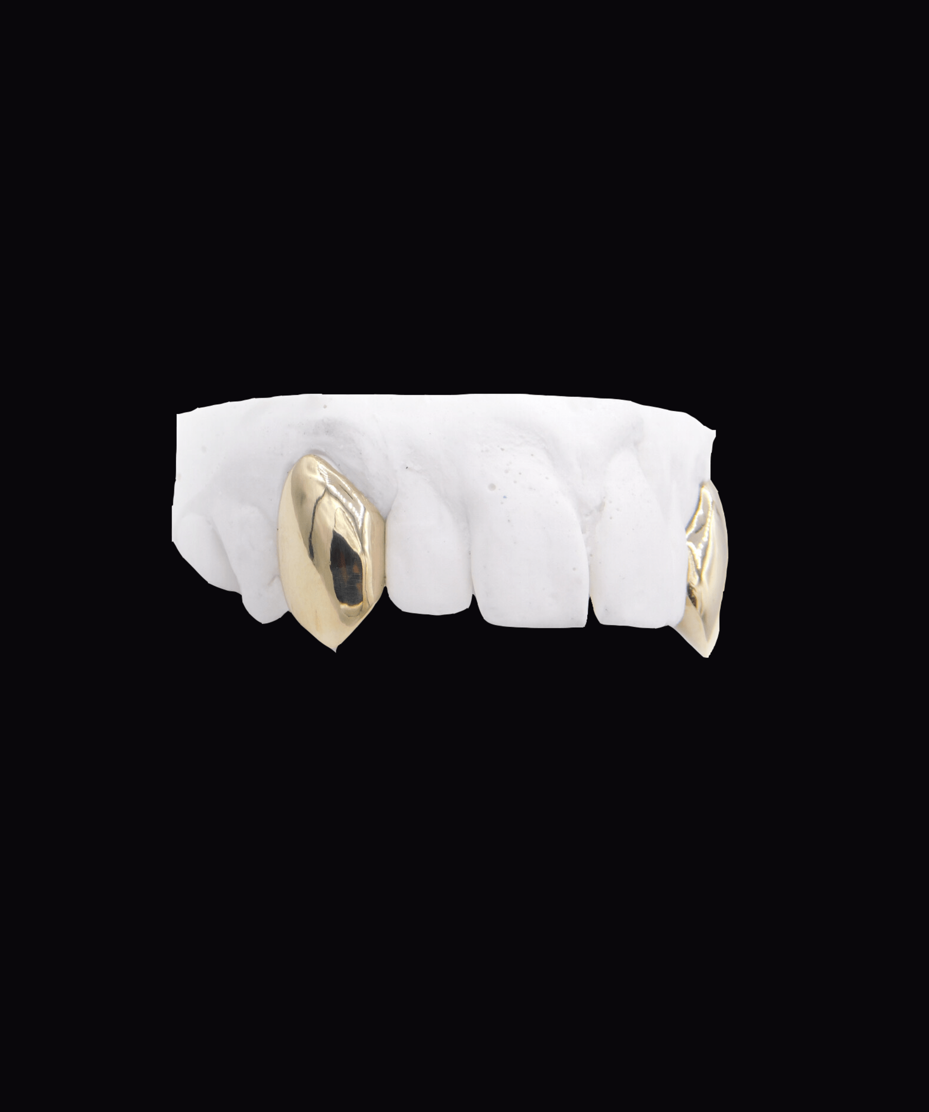 ICED London dental model: white teeth with gold crowns on molars, isolated on black background.