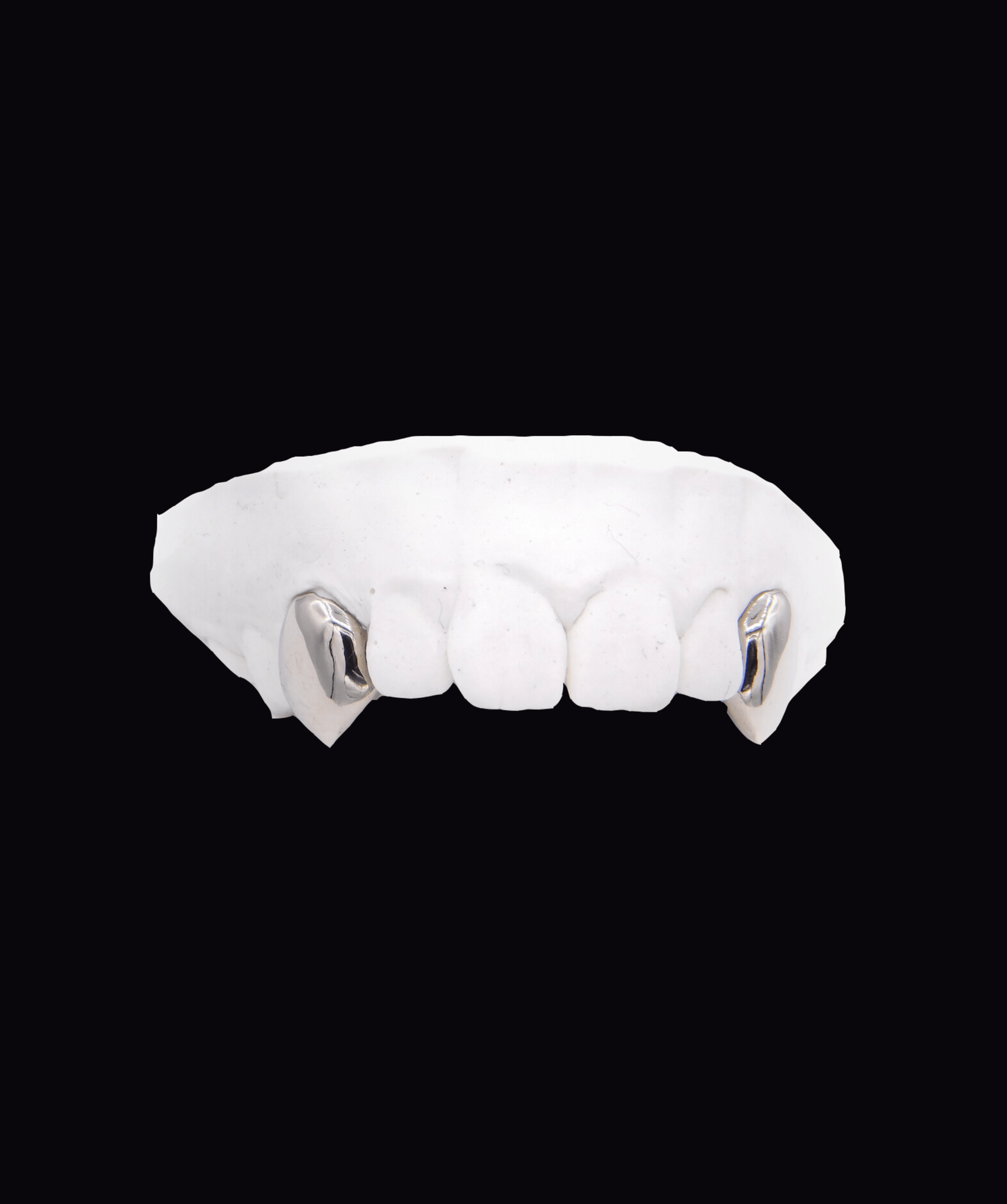 ICED London dental model of upper jaw with two metal crowns on canines, white plaster cast on black background.