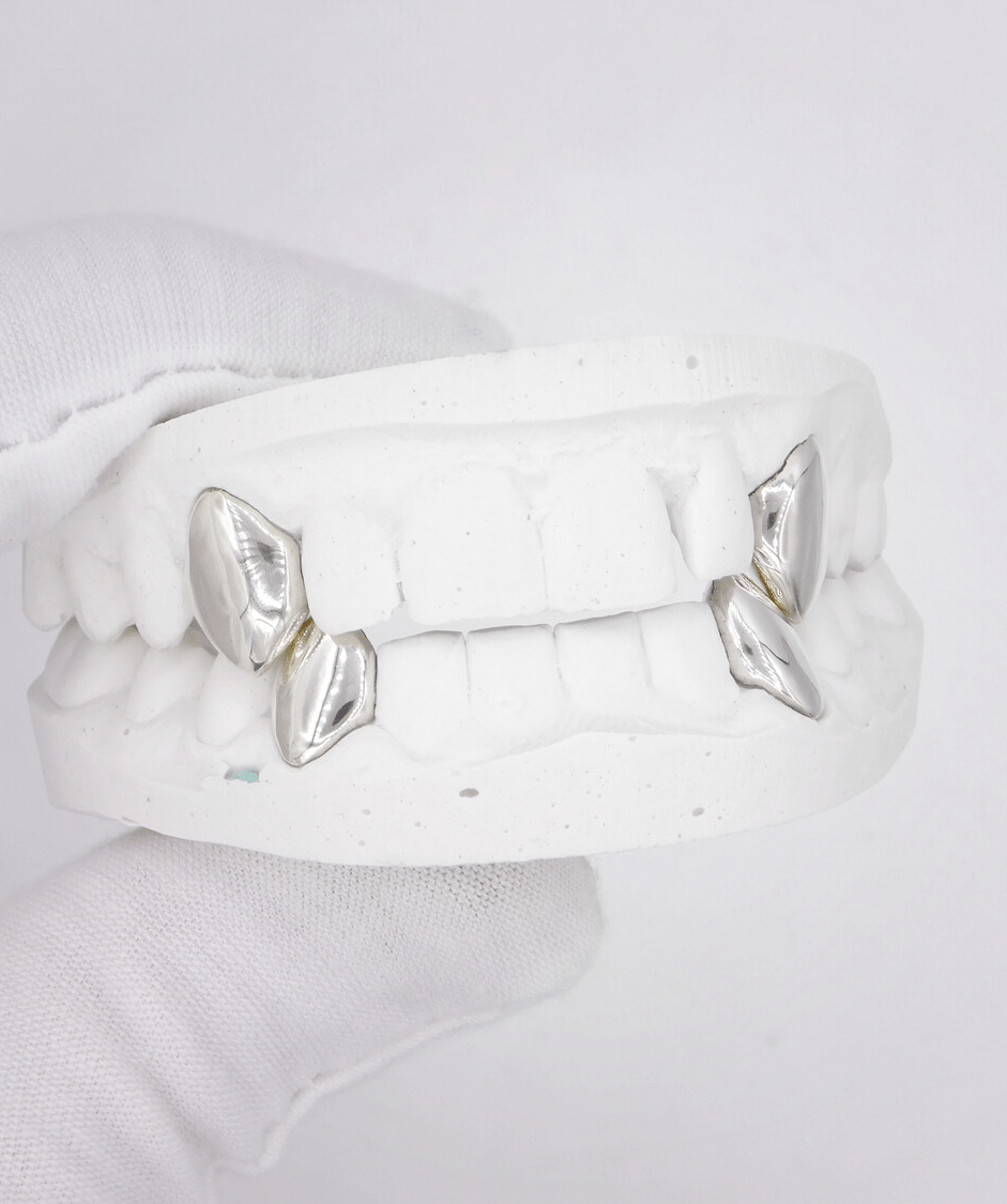 Dental model showcasing silver grillz on molars, white plaster cast, gloved hand — ICED London.