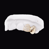 ICED London dental jewelry: gold tooth with a diamond-studded heart on a white dental model.