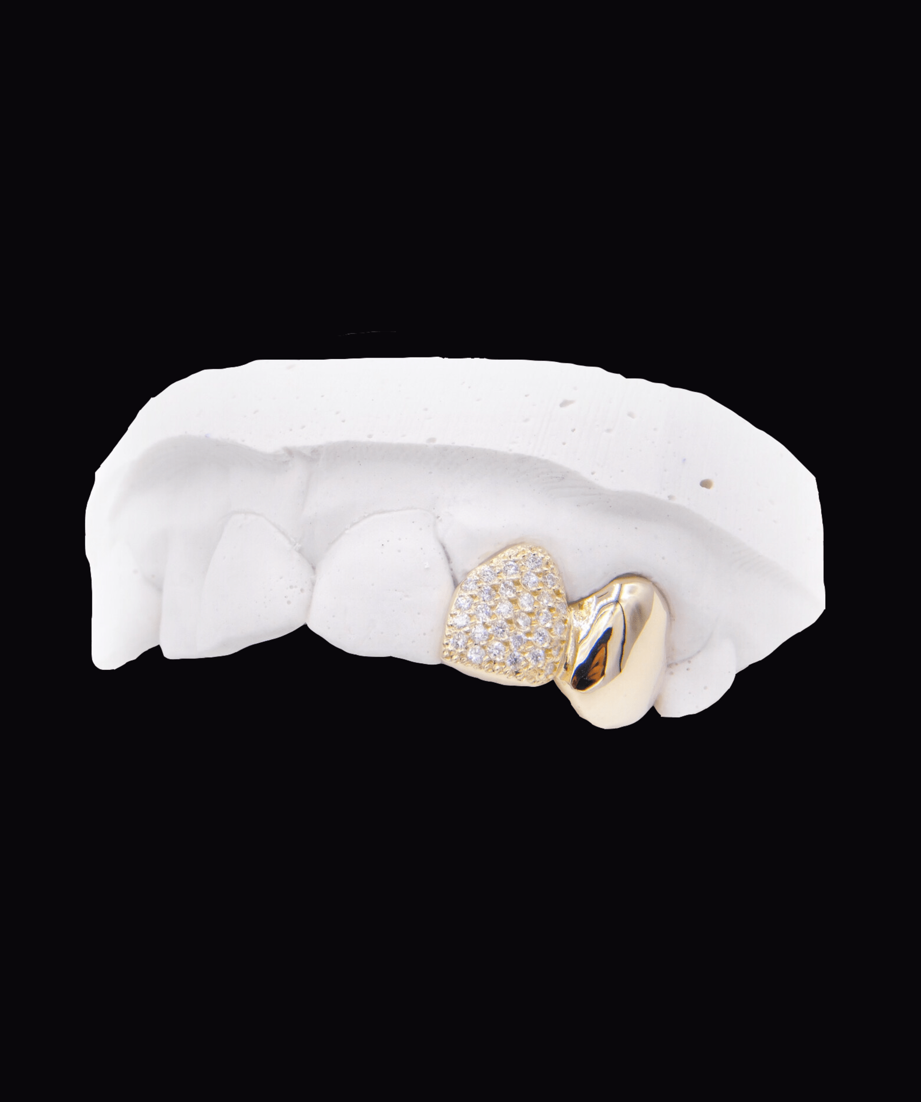 ICED London dental jewelry: gold tooth with a diamond-studded heart on a white dental model.
