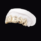 Gold dental crowns on a white dental model arch, close-up. ICED London.