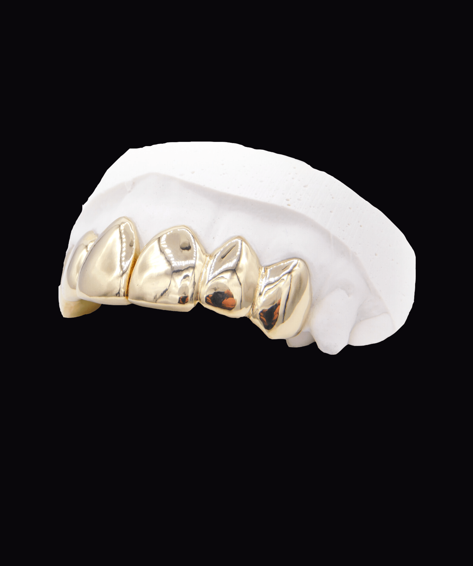 Gold dental crowns on a white dental model arch, close-up. ICED London.