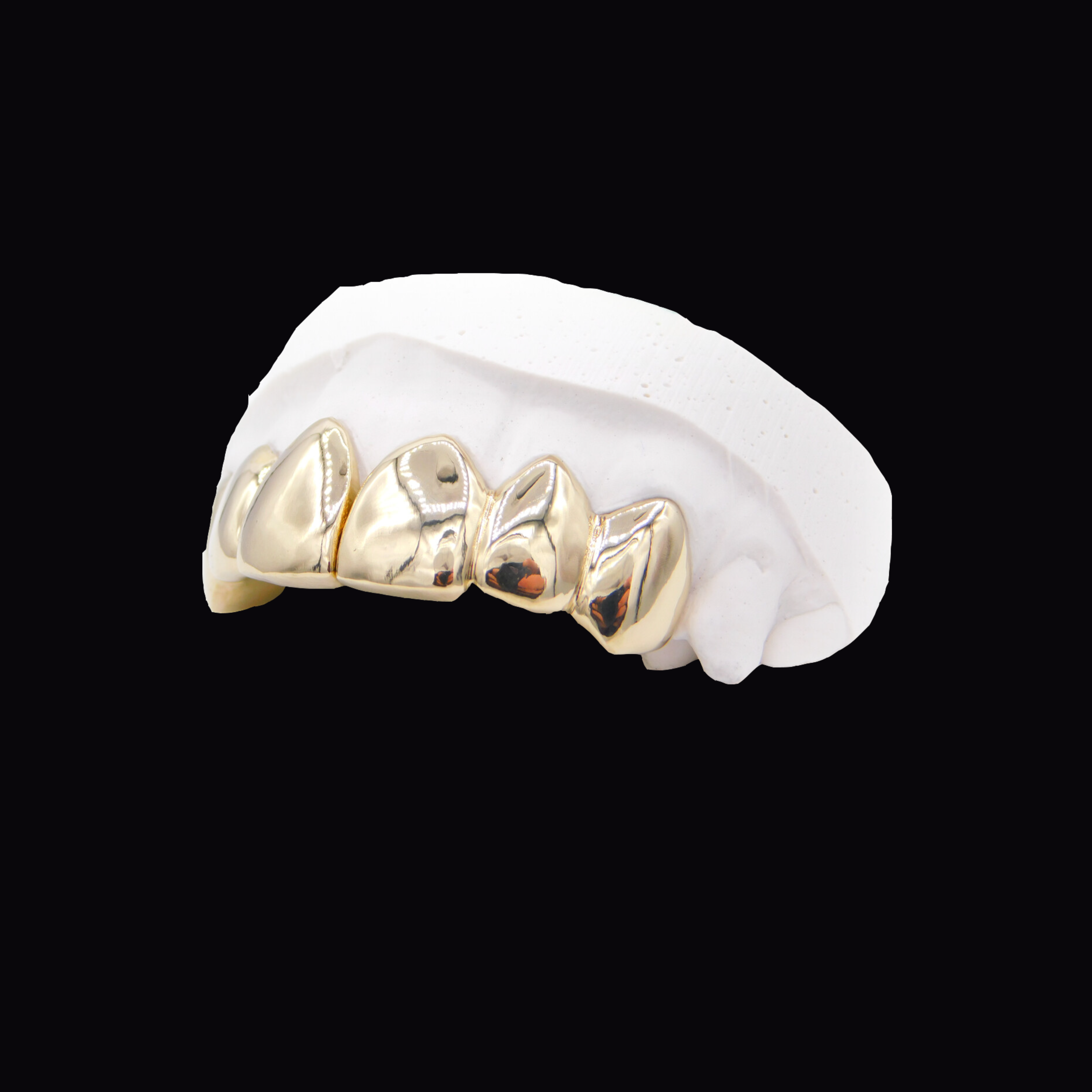 Upper Gold Grillz