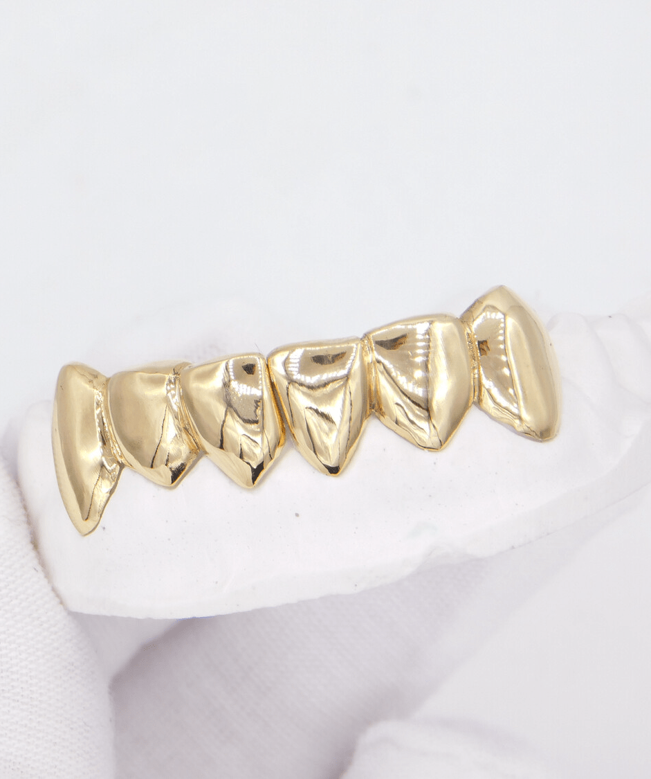 Gold-plated dental grillz set on a white dental cast, close-up studio shot. ICED London.
