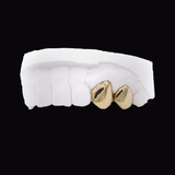 Dental model featuring two gold crowns on front teeth (cosmetic dentistry), ICED London.