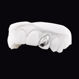 ICED London dental model showing a silver metallic crown on a front tooth, white gypsum cast against a black background.