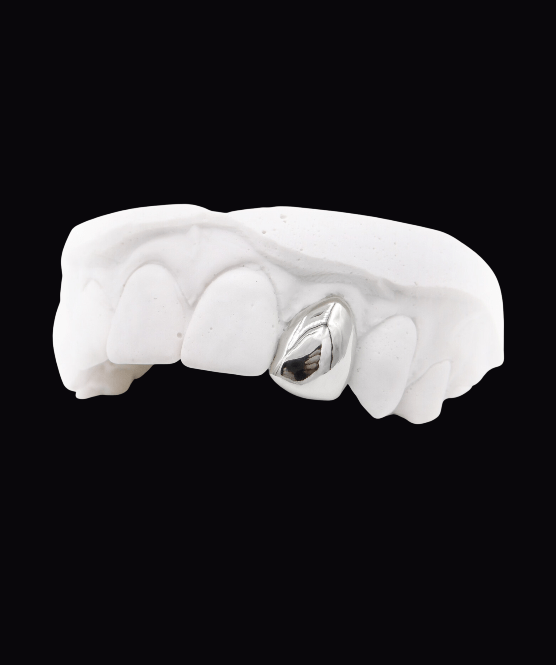 ICED London dental model showing a silver metallic crown on a front tooth, white gypsum cast against a black background.
