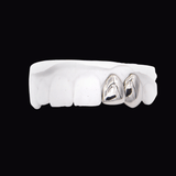 ICED London dental model showing two metallic crowns on the front teeth against a black background.