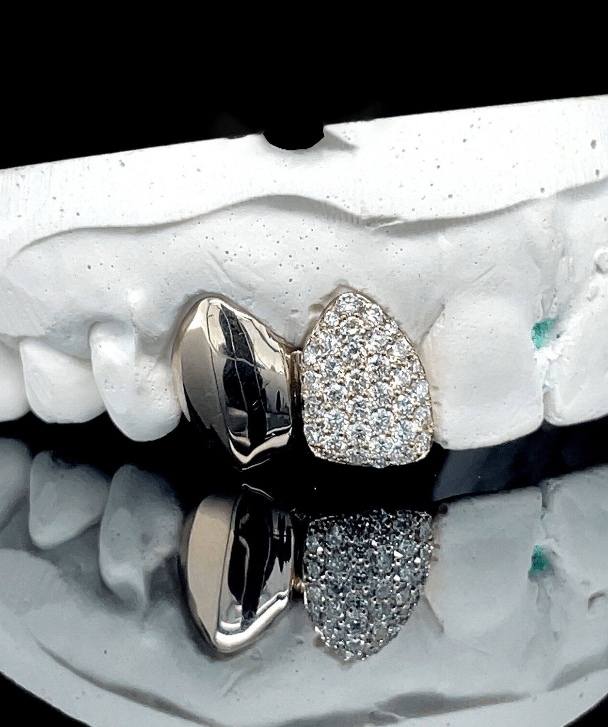 ICED London: dental model featuring a diamond-paved heart-shaped crown next to a metal clasp on a white plaster tooth arch.