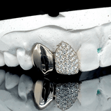 ICED London: dental model featuring a diamond-paved heart-shaped crown next to a metal clasp on a white plaster tooth arch.