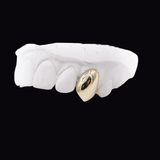 Dental plaster model showing a gold dental crown on a tooth, isolated on a black background. ICED London.