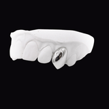ICED London dental model with a metallic crown on one front tooth among white teeth, on a black background.