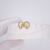 ICED London: close-up of a gold dental crown on a white model, highlighting crown contours and natural tooth shape.