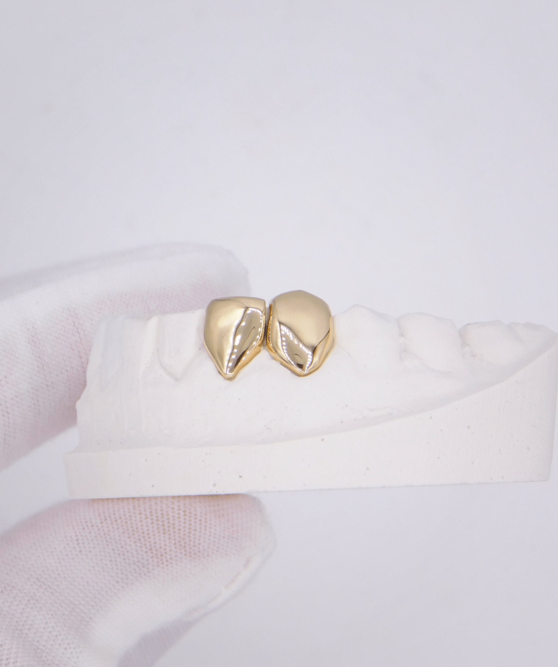 ICED London: close-up of a gold dental crown on a white model, highlighting crown contours and natural tooth shape.