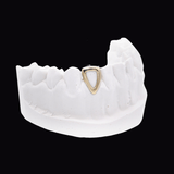 ICED London: gold triangular dental implant accessory attached to a white dental model (side view).