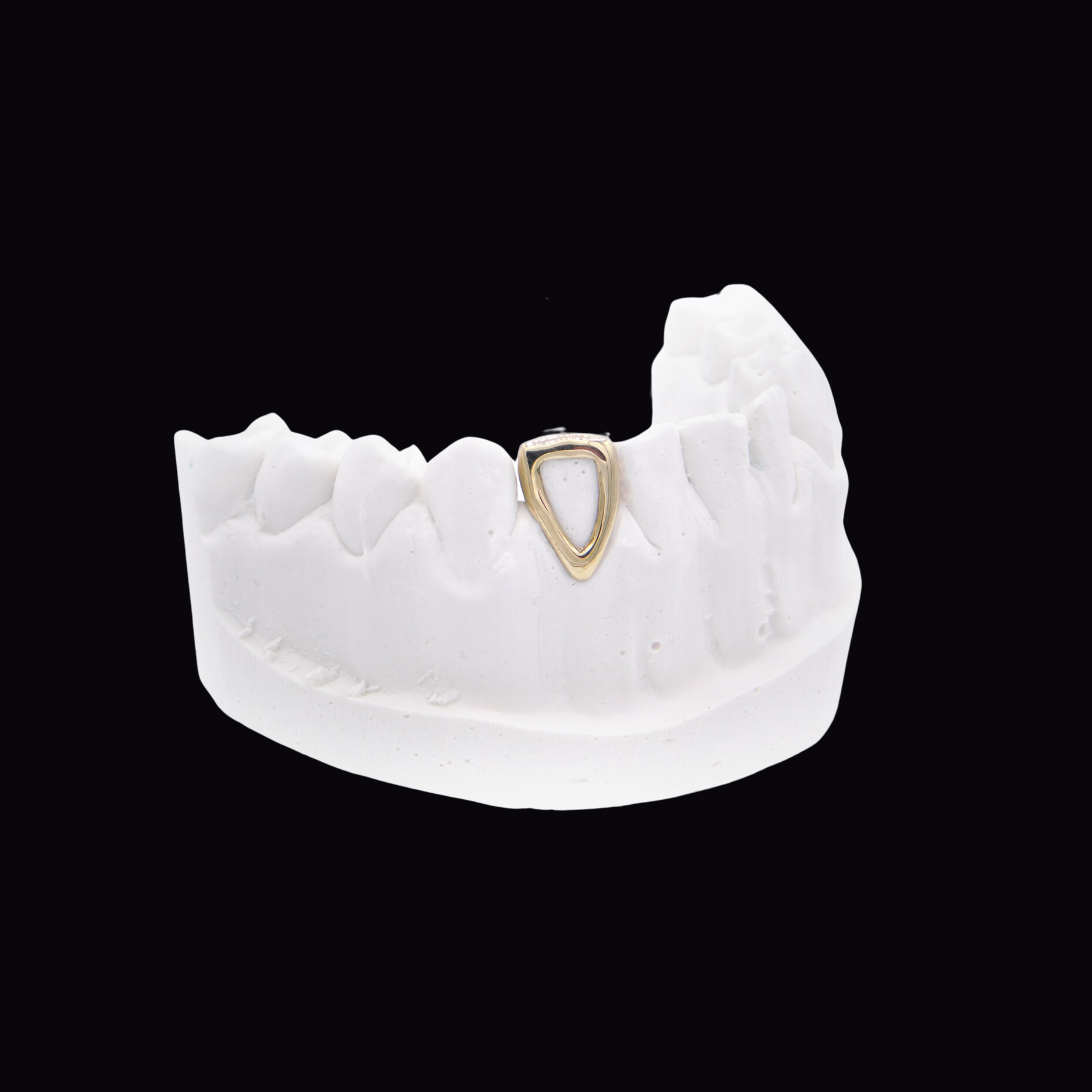 Gold Window Tooth