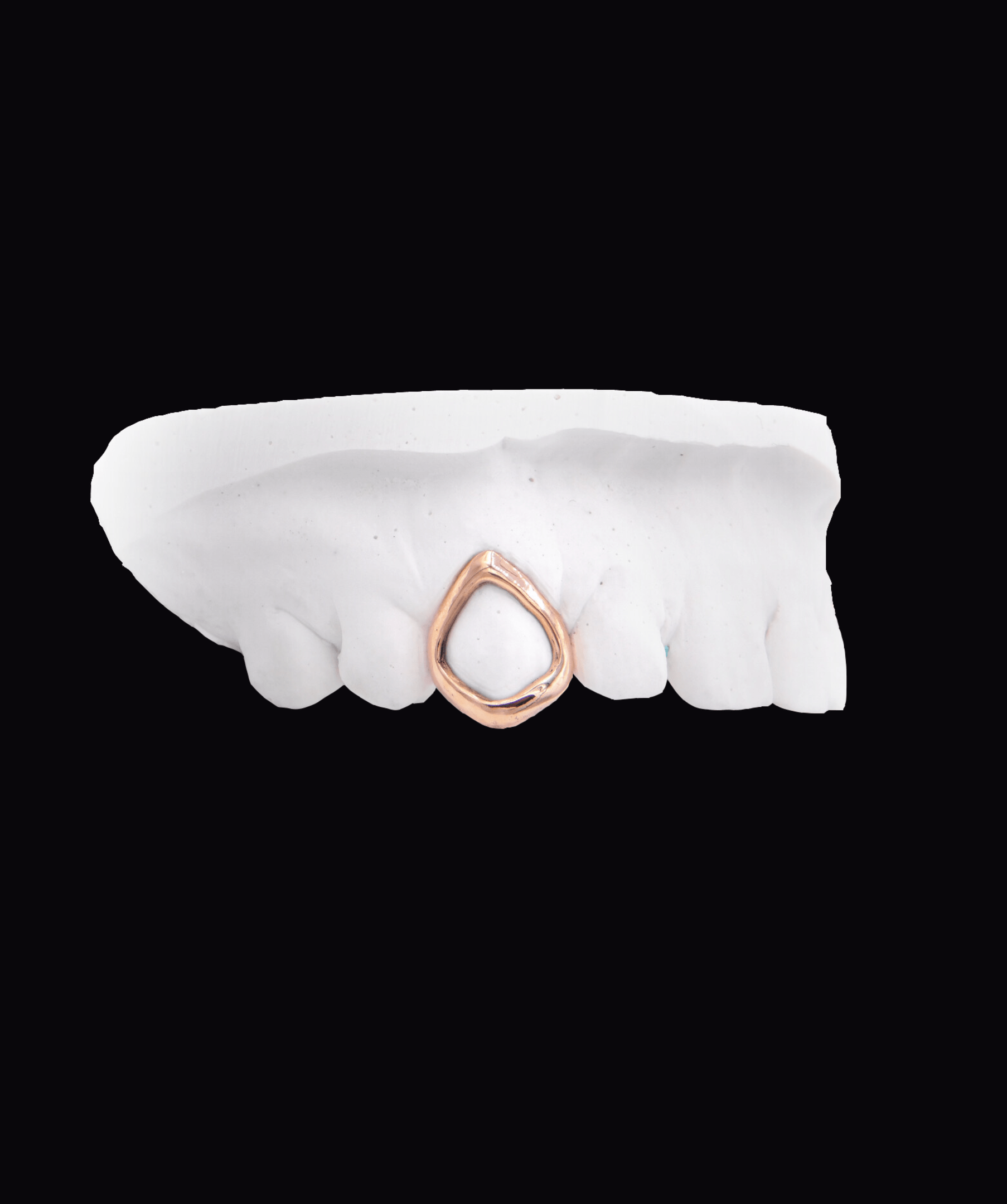 Rose gold teardrop ring placed on a white dental impression against a black background. ICED London.