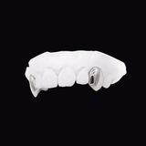 ICED London dental model: plaster cast with two metal crown restorations on the front teeth.