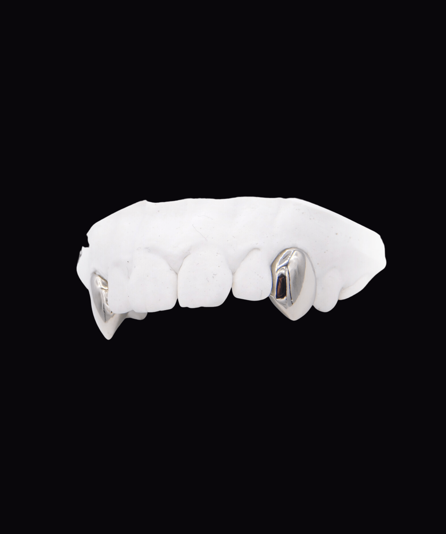 ICED London dental model: plaster cast with two metal crown restorations on the front teeth.