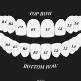 ICED London: top and bottom dental arches diagram with teeth labeled R1–R4, L1–L4 on a dark background.