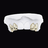 Upper dental model featuring gold crowns on the side incisors, white plaster arches, ICED London.