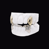 Dental plaster model with gold crowns on molars, showcasing dental restorations (ICED London).