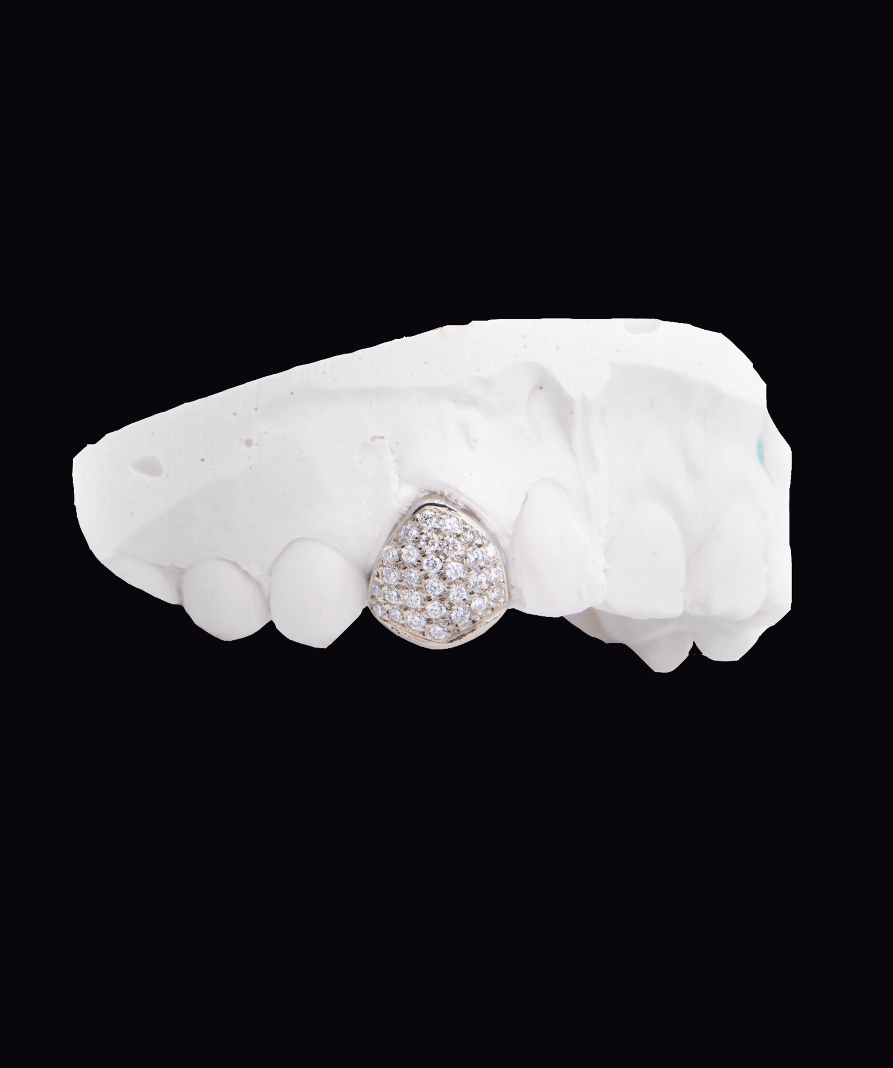 ICED London teardrop pave-diamond pendant placed on a white dental impression mold for jewelry and dental showcase.