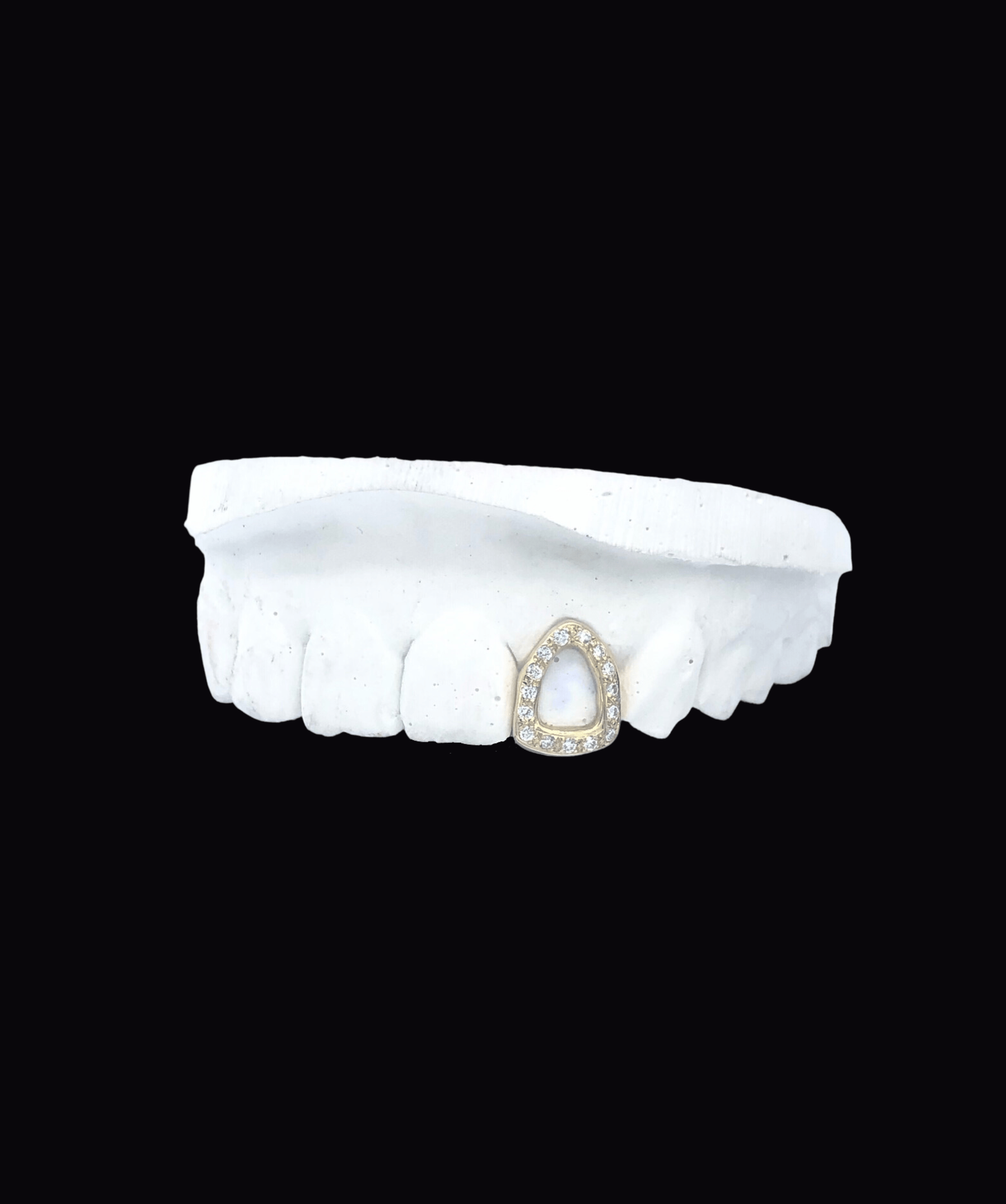 ICED London: white dental model featuring a teardrop-shaped diamond halo pendant embedded on the front tooth.