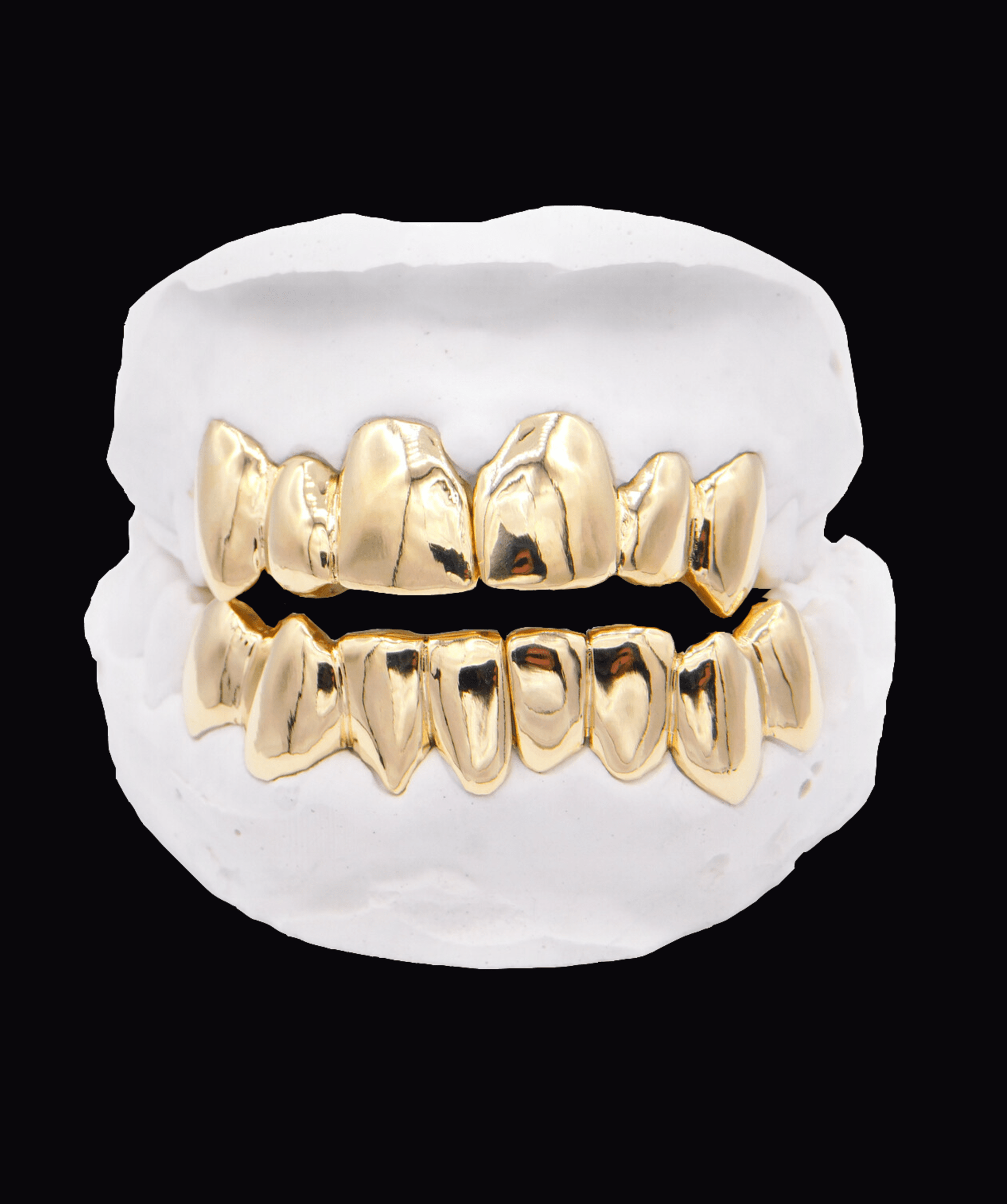 Close-up of gold grillz on a dental mold, showcasing ICED London dental jewelry.
